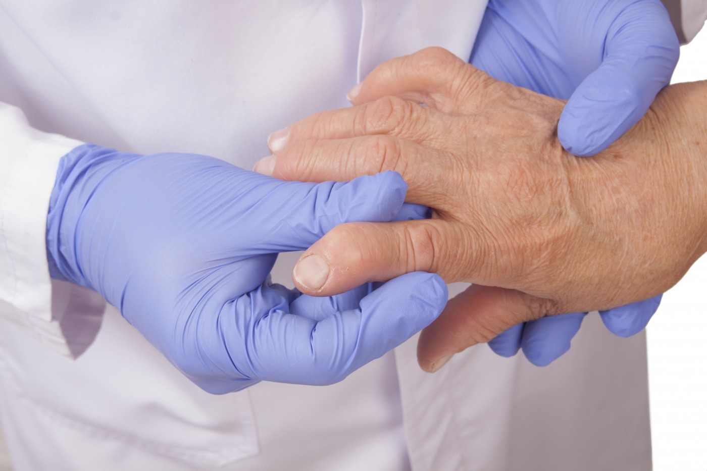 Older Rheumatoid Arthritis Patients May Underestimate Disease Activity