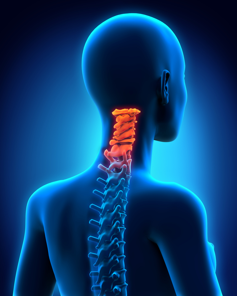Rheumatoid Arthritis Patients Are Still Affected by with Cervical Spine Complications