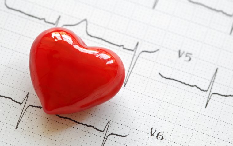 Good HDL levels can reduce risk for cardiovascular events in RA patients